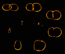 Kosmische Strings