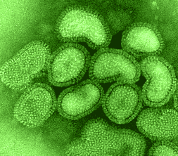 Influenza- Virus